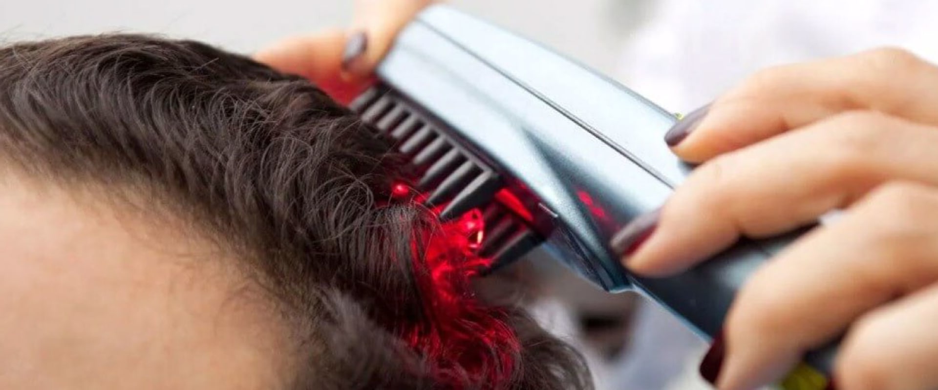 Exploring Low-level Laser Therapy (LLLT) for Baldness and Hair Loss