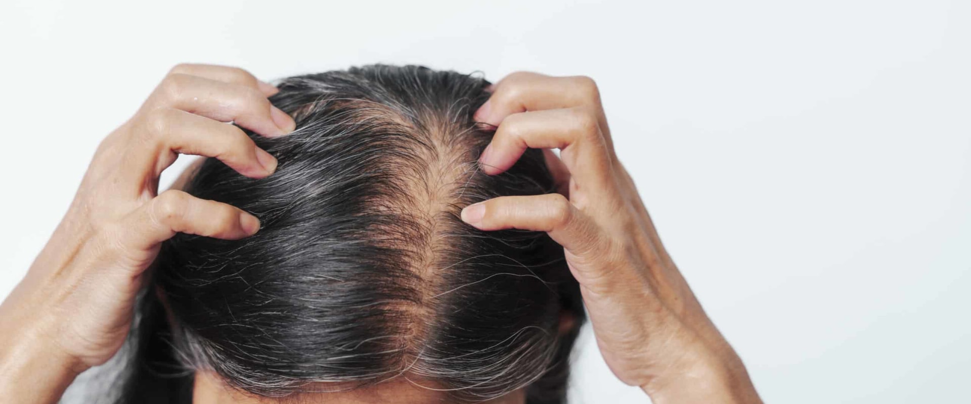Lifestyle Factors and Female Hair Loss: How to Prevent, Slow Down, and Restore Your Hair