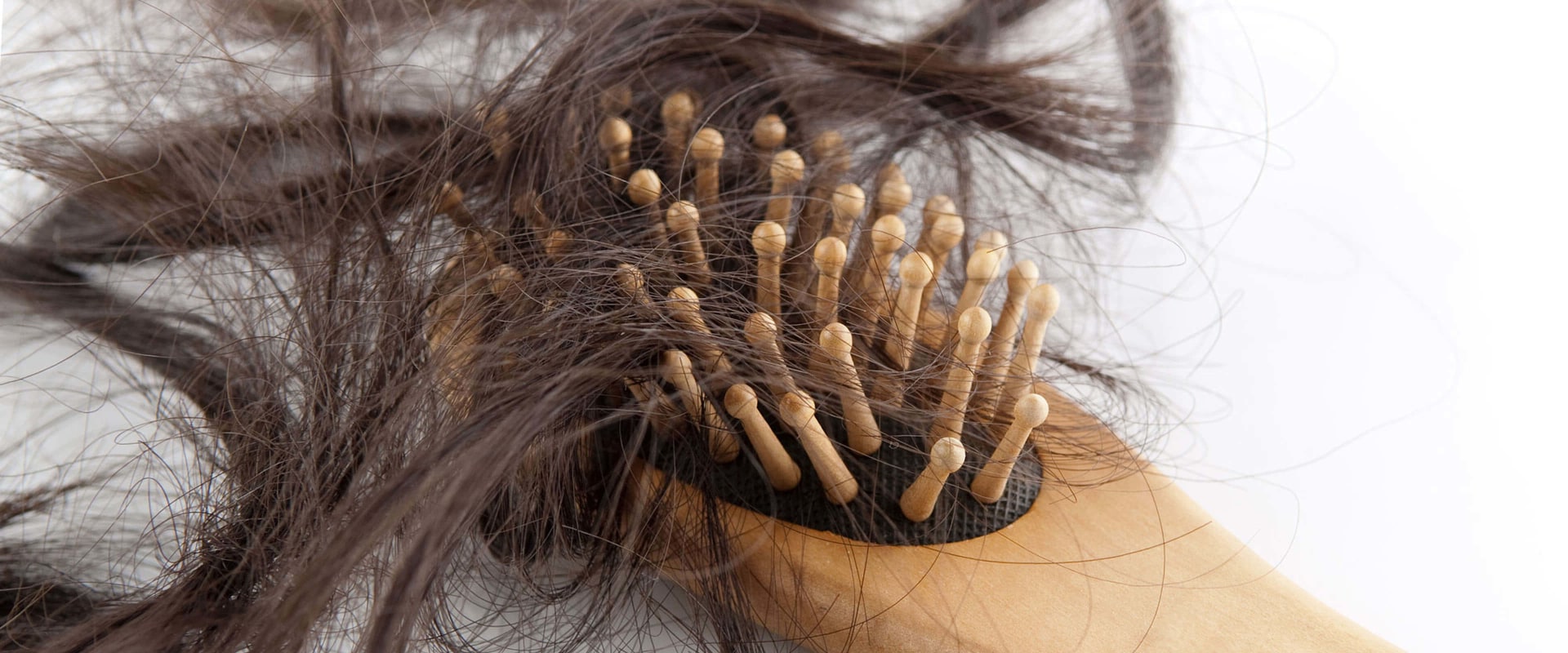 Pregnancy and Postpartum Hair Loss: Causes, Prevention, and Treatment