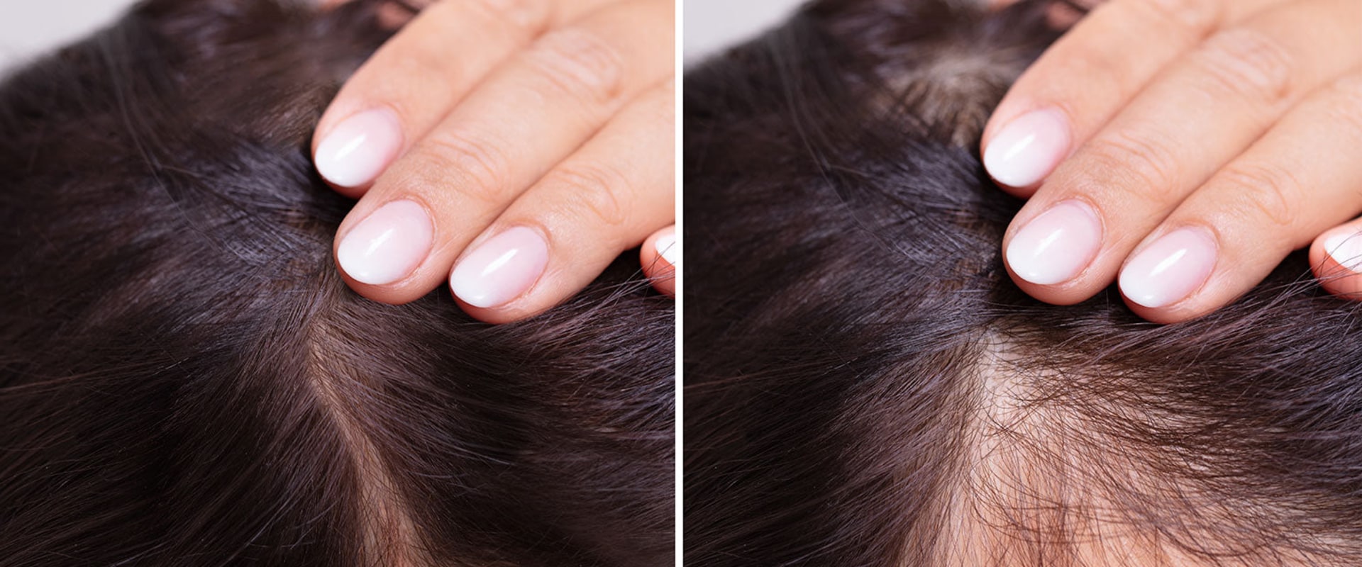 Hair Thickening Sprays: The Ultimate Guide to Preventing Baldness and Promoting Hair Growth