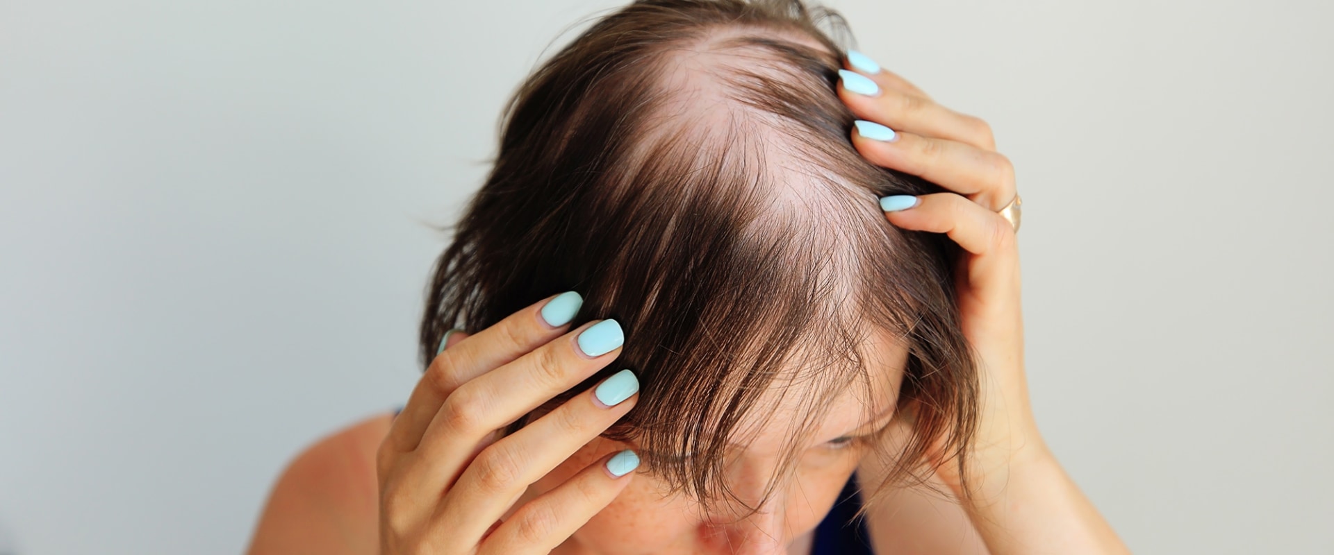 Hair Care Routine for Managing Female Hair Loss: Tips and Tricks for Prevention and Management