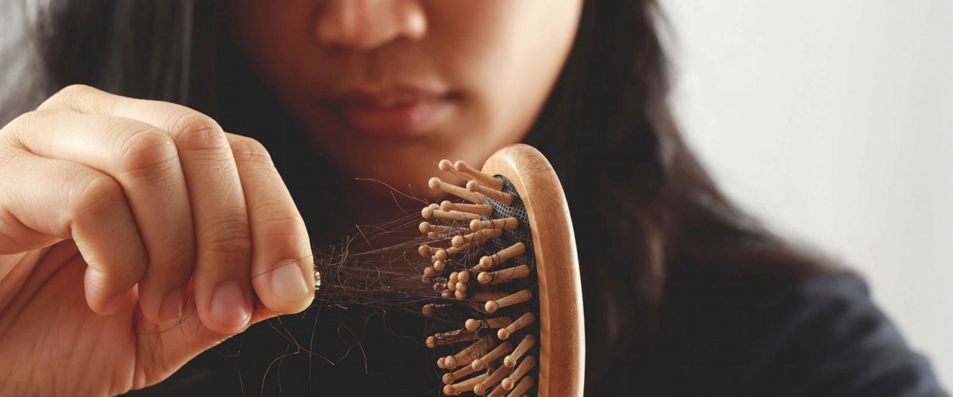 Natural Remedies for Female Hair Loss: Effective Solutions for Women