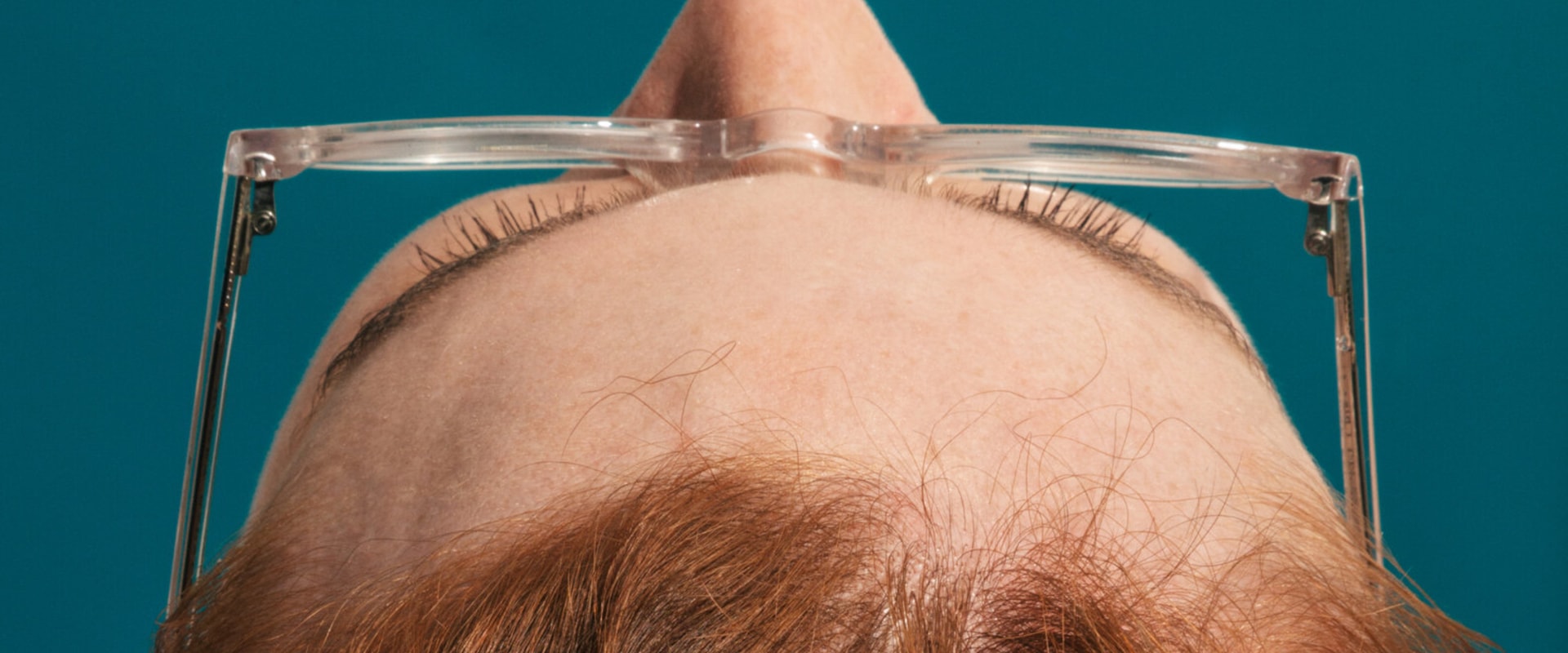 Understanding Menopause and Hair Loss: What You Need to Know