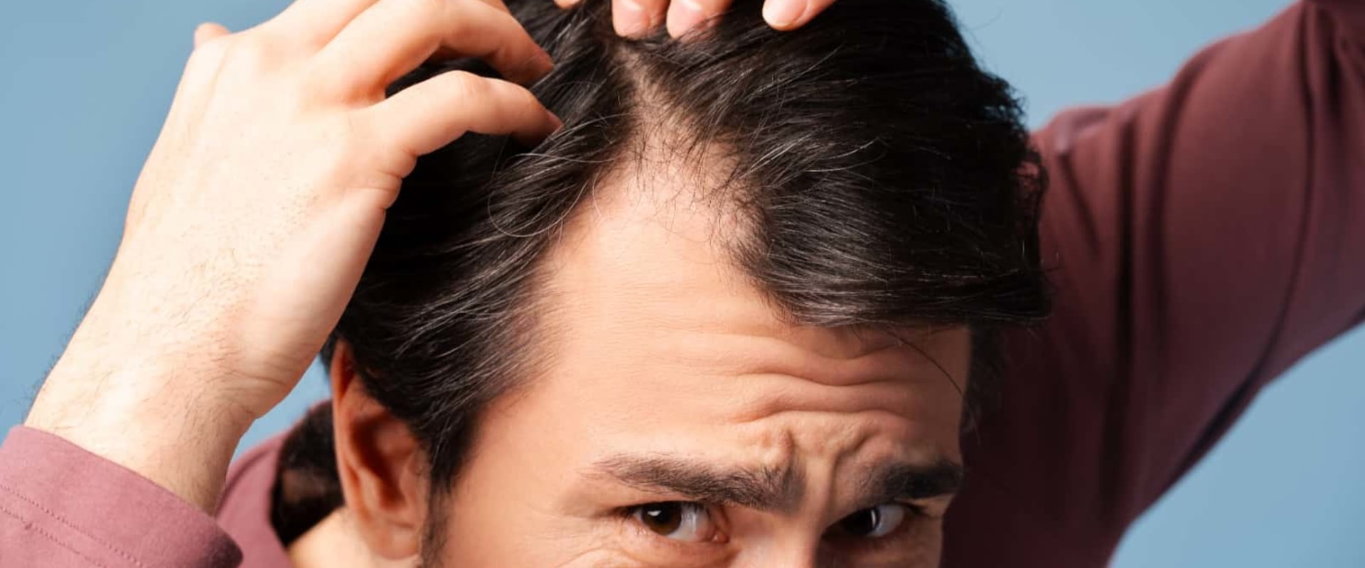 Understanding Finasteride: Preventing Baldness and Restoring Hair Growth