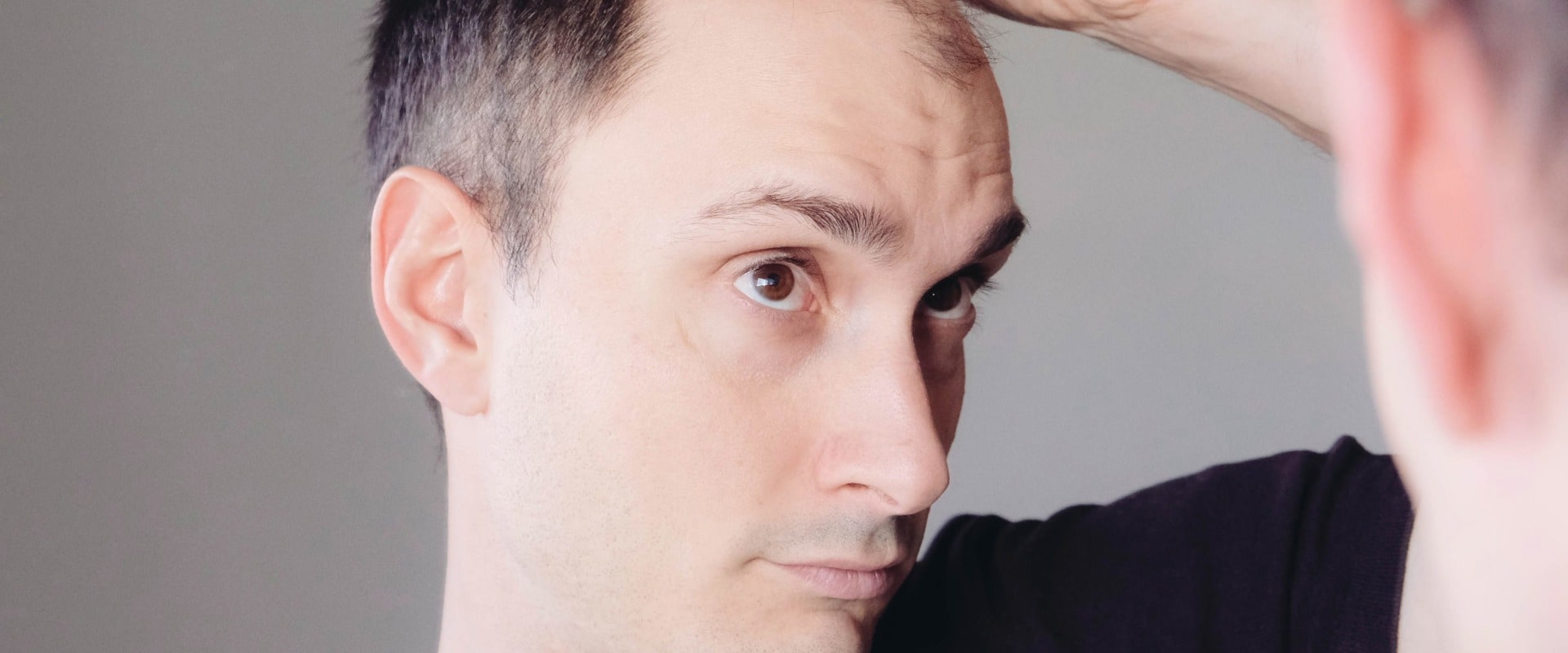 Lifestyle Changes for Preventing Male Pattern Baldness: Expert Tips and Advice
