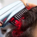 Exploring Low-level Laser Therapy (LLLT) for Baldness and Hair Loss