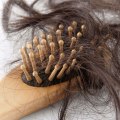 Pregnancy and Postpartum Hair Loss: Causes, Prevention, and Treatment