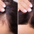 Hair Thickening Sprays: The Ultimate Guide to Preventing Baldness and Promoting Hair Growth