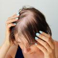 Hair Care Routine for Managing Female Hair Loss: Tips and Tricks for Prevention and Management