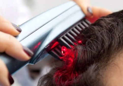 Exploring Low-level Laser Therapy (LLLT) for Baldness and Hair Loss