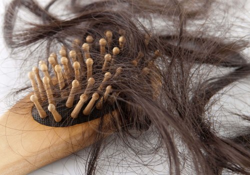 Pregnancy and Postpartum Hair Loss: Causes, Prevention, and Treatment