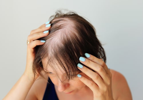 Hair Care Routine for Managing Female Hair Loss: Tips and Tricks for Prevention and Management